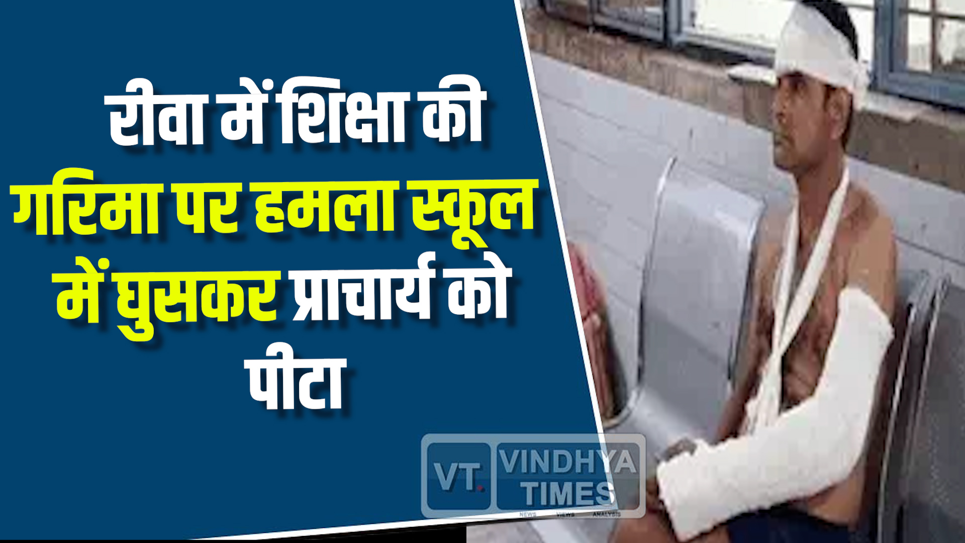 Rewa News : रीवा में स्कूल के छात्रों के विवाद सुलझाने पर प्राचार्य पर जानलेवा हमला