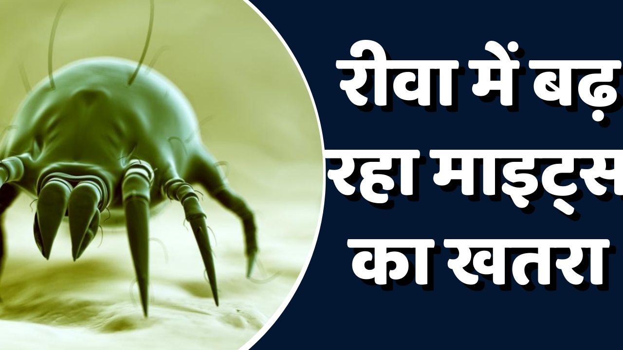 Rewa News: रीवा में इस भयानक बीमारी का प्रकोप , कहीं आप में भी तो नही दिख रहें इए लक्षण
