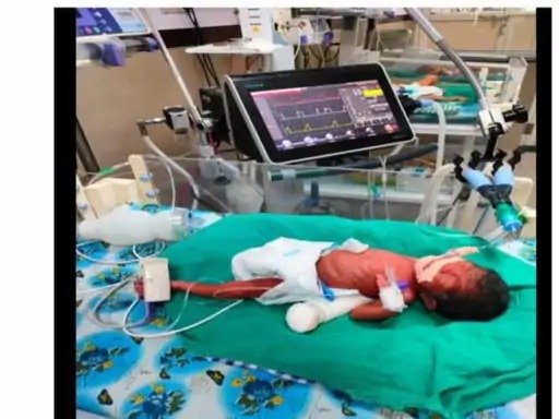 Rewa News: रीवा एसएनसीयू की बड़ी सफलता: 750 ग्राम के नवजात को मिला नया जीवन