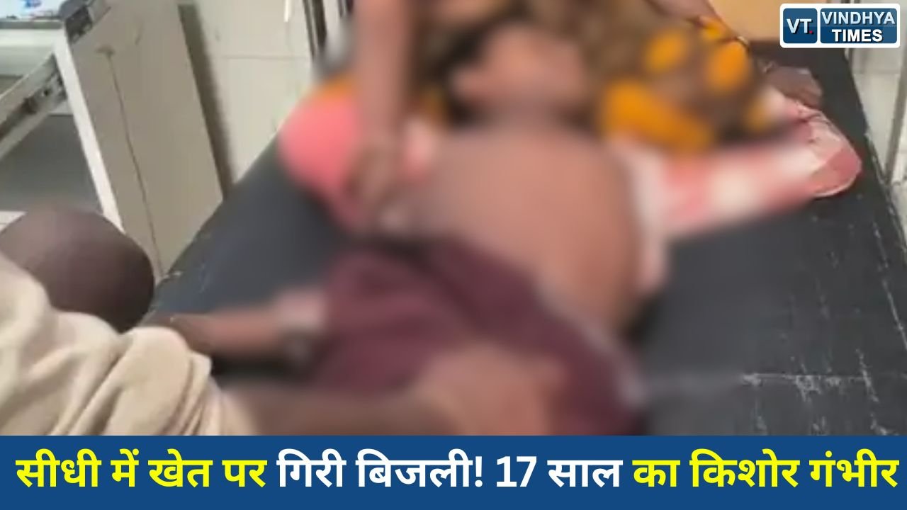 Sidhi News: सीधी जिले में खेत में काम कर रहे नाबालिग पर गिरी आकाशीय बिजली, गंभीर हालत में अस्पताल में भर्ती