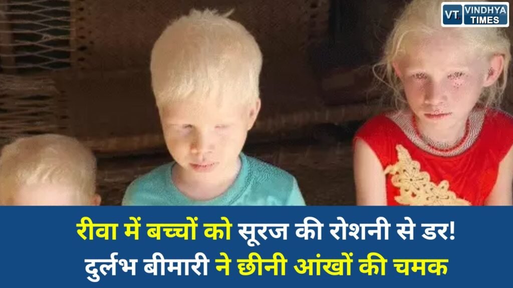 Rewa News: रीवा के 4 मासूम ‘एल्बिनिज्म’ बीमारी से पीड़ित, धूप में जाते ही बंद हो जाती हैं आंखें, अंधेरे में जीने को मजबूर परिवार