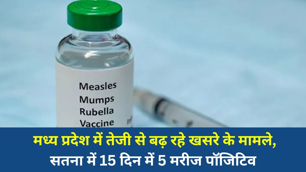 MP News: मध्य प्रदेश में तेजी से बढ़ रहे खसरे के मामले, सतना में 15 दिन में 5 मरीज पॉजिटिव