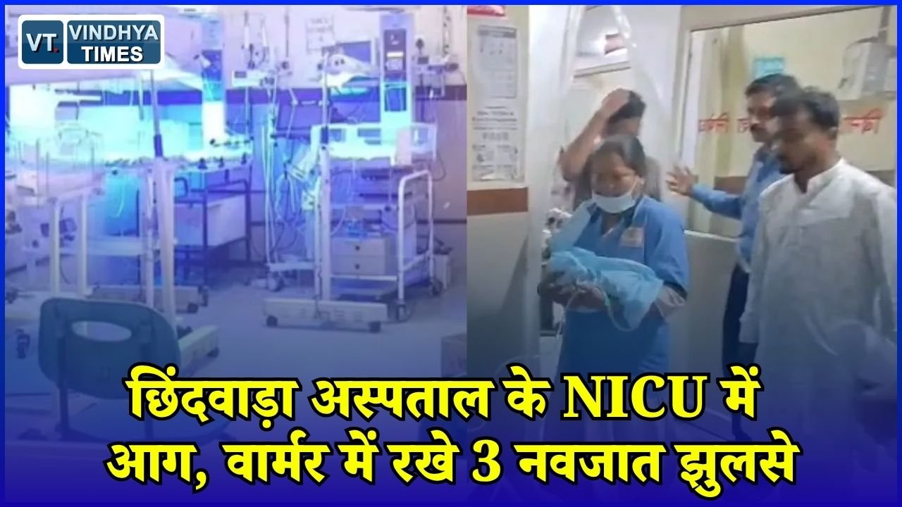 MP News: छिंदवाड़ा जिला अस्पताल के NICU में बड़ा हादसा, वार्मर में आग लगने से तीन नवजात झुलसे