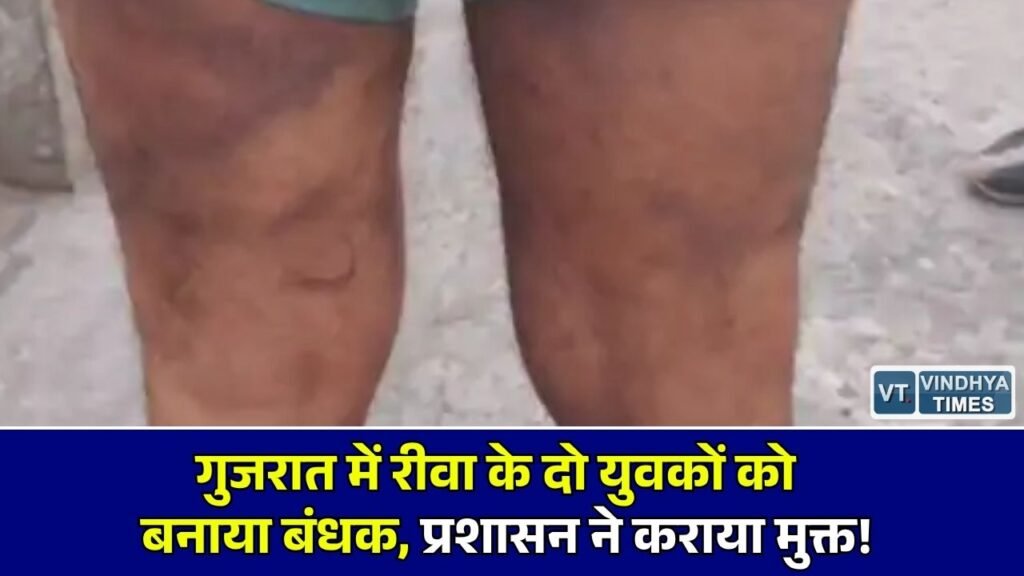 Rewa News: गुजरात में रीवा के दो कर्मचारियों को 8 दिनों तक बंधक बनाकर बर्बरता, रीवा पुलिस के हस्तक्षेप से छूटे पीड़ित